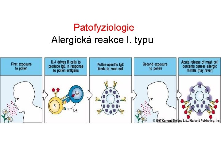 Patofyziologie Alergická reakce I. typu 