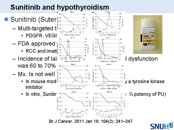 Sunitinib and hypothyroidism l Sunitinib (Sutent) – Multi-targeted tyrosine kinase inhibitor • PDGFR, VEGFR, Sunitinib and hypothyroidism l Sunitinib (Sutent) – Multi-targeted tyrosine kinase inhibitor • PDGFR, VEGFR,
