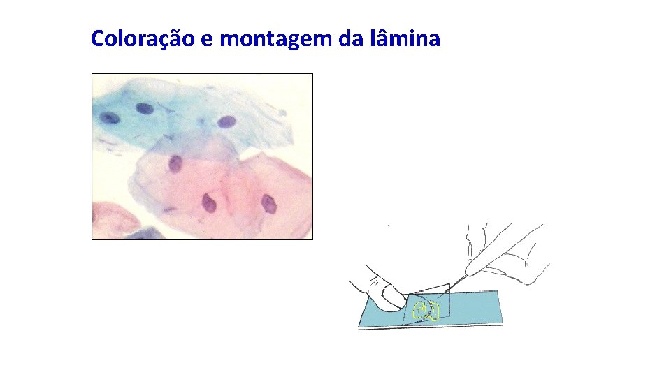 Coloração e montagem da lâmina 