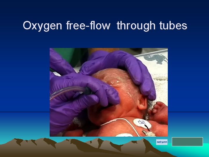 Oxygen free-flow through tubes 