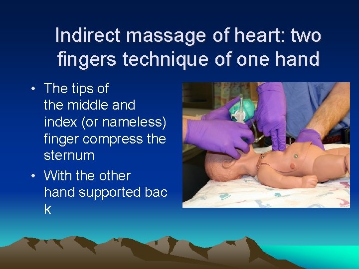 Indirect massage of heart: two fingers technique of one hand • The tips of