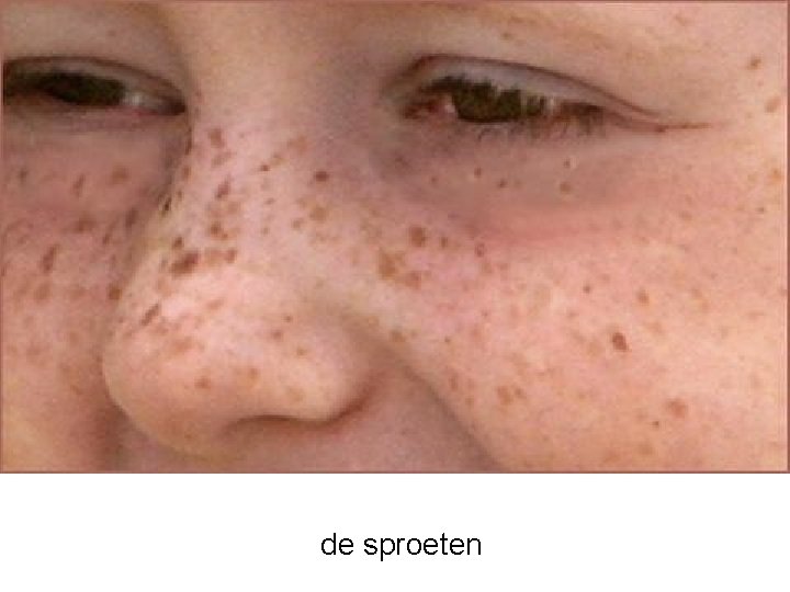 de sproeten 