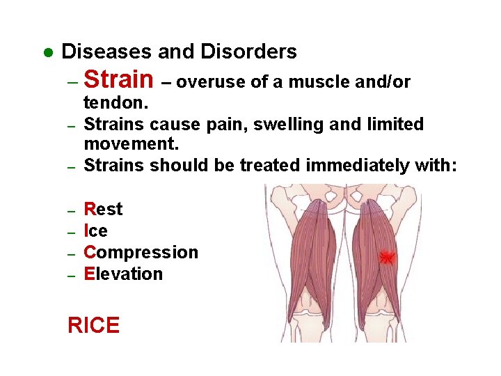 l Diseases and Disorders – Strain – overuse of a muscle and/or – –