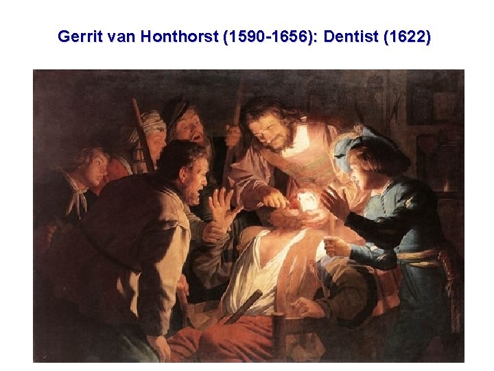 Gerrit van Honthorst (1590 -1656): Dentist (1622) 