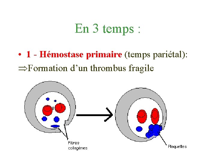 En 3 temps : • 1 - Hémostase primaire (temps pariétal): Formation d’un thrombus