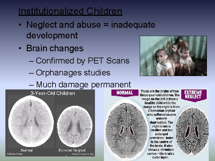 Institutionalized Children • Neglect and abuse = inadequate development • Brain changes – Confirmed Institutionalized Children • Neglect and abuse = inadequate development • Brain changes – Confirmed