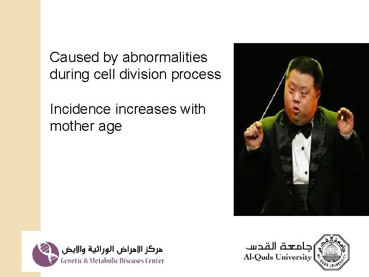 Caused by abnormalities during cell division process Incidence increases with mother age 