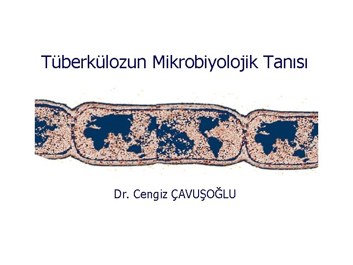 Tüberkülozun Mikrobiyolojik Tanısı Dr. Cengiz ÇAVUŞOĞLU 