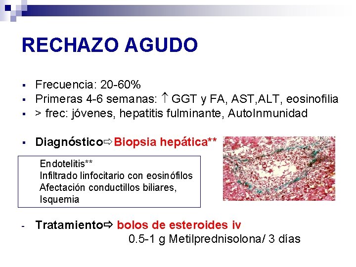 RECHAZO AGUDO § Frecuencia: 20 -60% Primeras 4 -6 semanas: GGT y FA, AST, RECHAZO AGUDO § Frecuencia: 20 -60% Primeras 4 -6 semanas: GGT y FA, AST,