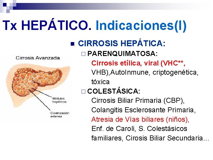 Tx HEPÁTICO. Indicaciones(I) n CIRROSIS HEPÁTICA: ¨ PARENQUIMATOSA: Cirrosis etílica, viral (VHC**, VHB), Auto. Tx HEPÁTICO. Indicaciones(I) n CIRROSIS HEPÁTICA: ¨ PARENQUIMATOSA: Cirrosis etílica, viral (VHC**, VHB), Auto.