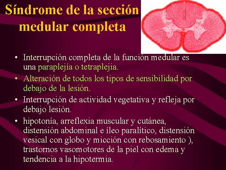 Síndrome de la sección medular completa • Interrupción completa de la función medular es