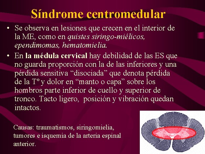 Síndrome centromedular • Se observa en lesiones que crecen en el interior de la