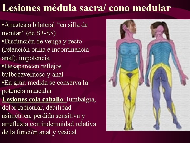 Lesiones médula sacra/ cono medular • Anestesia bilateral “en silla de montar” (de S