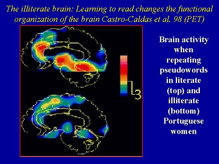 The illiterate brain: Learning to read changes the functional organization of the brain Castro-Caldas