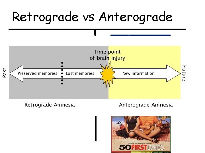 Retrograde vs Anterograde 