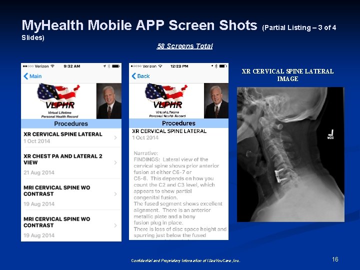 My. Health Mobile APP Screen Shots (Partial Listing – 3 of 4 Slides) 58 My. Health Mobile APP Screen Shots (Partial Listing – 3 of 4 Slides) 58