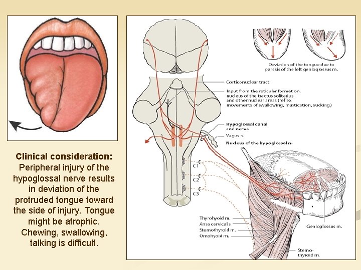 Clinical consideration: Peripheral injury of the hypoglossal nerve results in deviation of the protruded