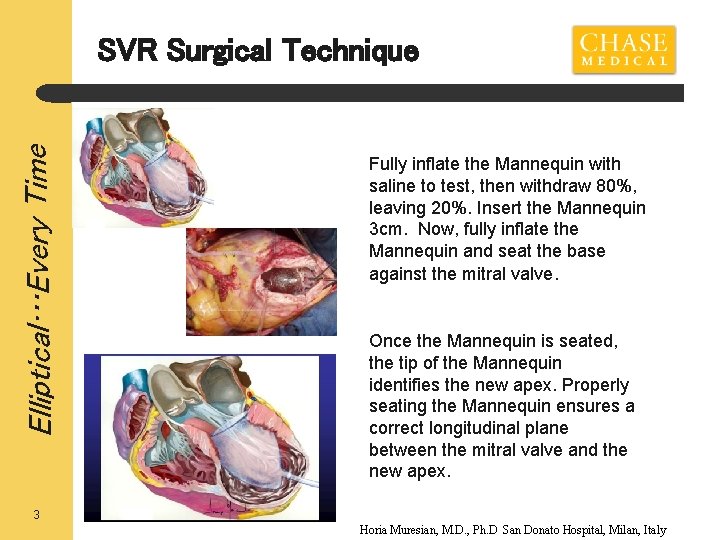 Elliptical…Every Time SVR Surgical Technique Fully inflate the Mannequin with saline to test, then