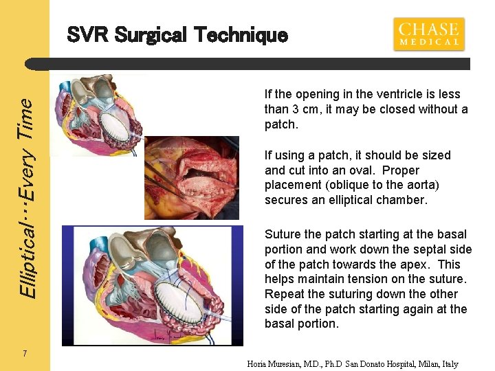 Elliptical…Every Time SVR Surgical Technique If the opening in the ventricle is less than