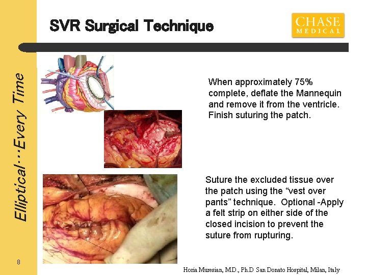 Elliptical…Every Time SVR Surgical Technique When approximately 75% complete, deflate the Mannequin and remove