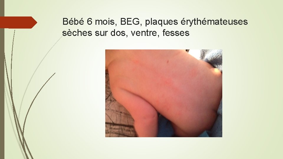 Fomecor 6 Mois Beg Plaques Rythmateuses