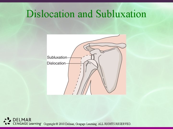 Dislocation and Subluxation Copyright © 2010 Delmar, Cengage Learning. ALL RIGHTS RESERVED. 