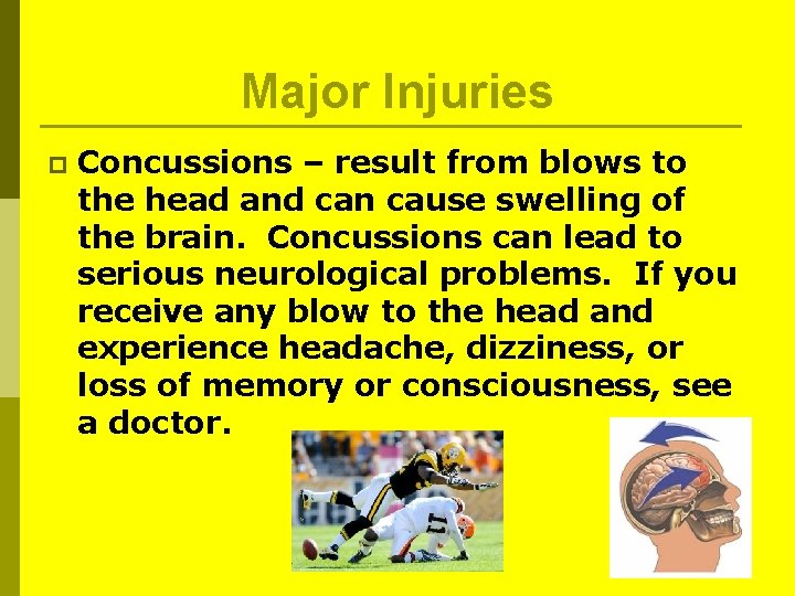 Major Injuries p Concussions – result from blows to the head and can cause Major Injuries p Concussions – result from blows to the head and can cause