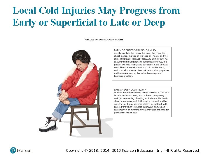 Local Cold Injuries May Progress from Early or Superficial to Late or Deep Copyright