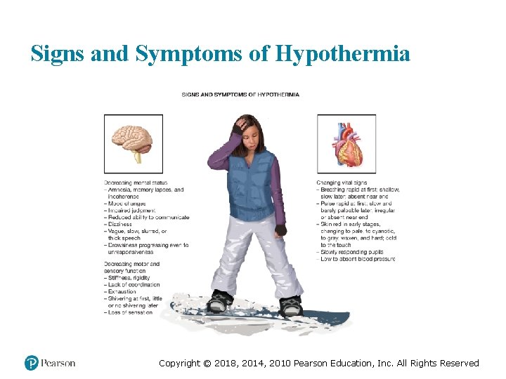 Signs and Symptoms of Hypothermia Copyright © 2018, 2014, 2010 Pearson Education, Inc. All