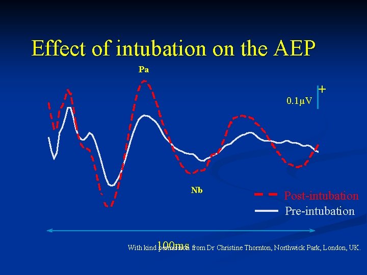 Effect of intubation on the AEP Pa 0. 1µV Nb 100 ms + Post-intubation Effect of intubation on the AEP Pa 0. 1µV Nb 100 ms + Post-intubation