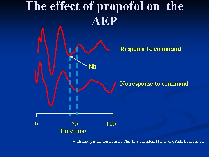 The effect of propofol on the AEP Response to command Nb No response to The effect of propofol on the AEP Response to command Nb No response to