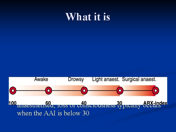 What it is n AAI is typically higher than 60 when the patient is What it is n AAI is typically higher than 60 when the patient is