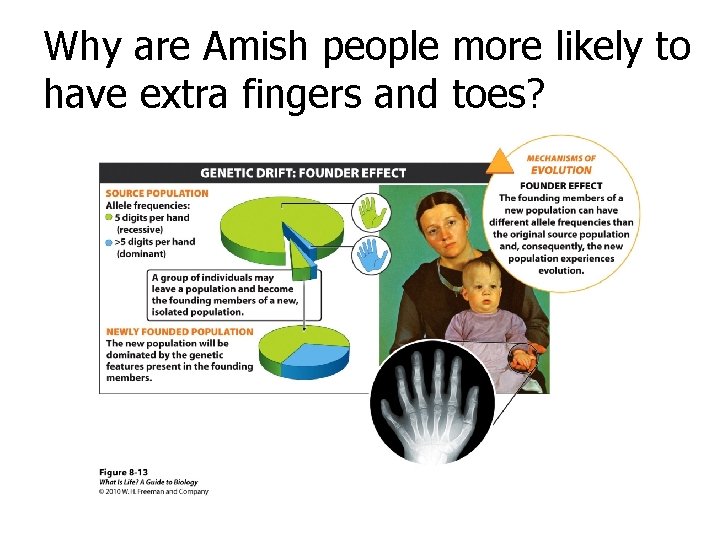 Why are Amish people more likely to have extra fingers and toes? 