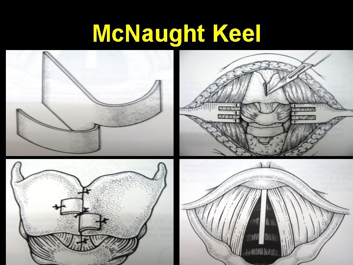 Mc. Naught Keel 