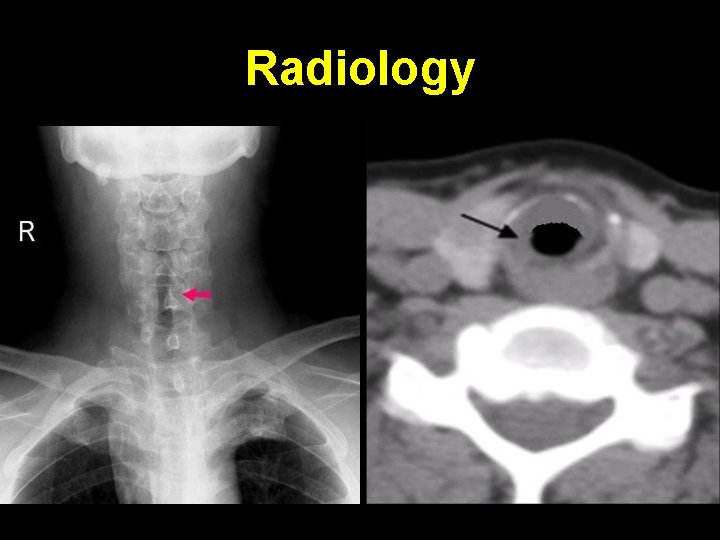 Radiology 