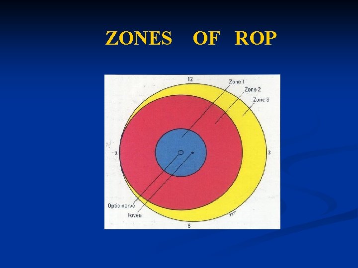 ZONES OF ROP ZONES OF ROP