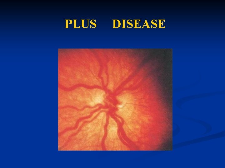 PLUS DISEASE PLUS DISEASE