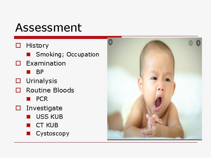 Assessment o History n Smoking; Occupation o Examination n BP o Urinalysis o Routine