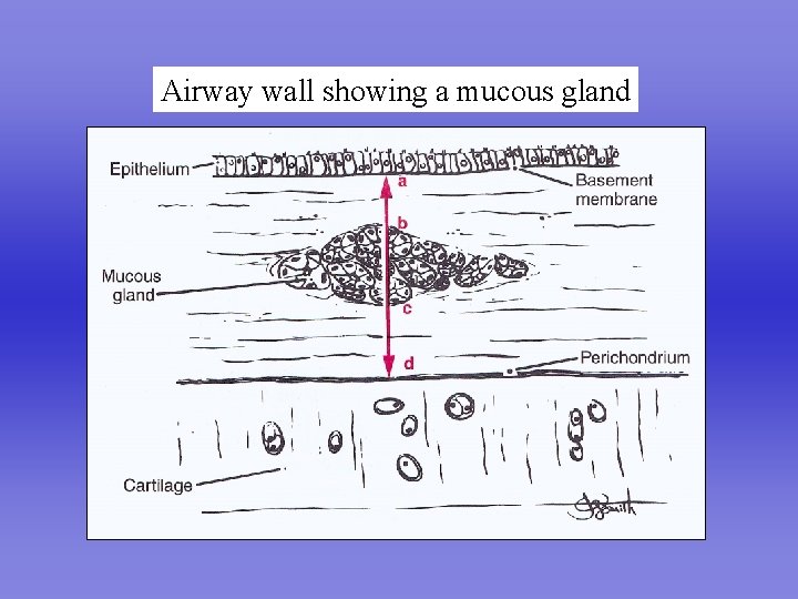 Airway wall showing a mucous gland 