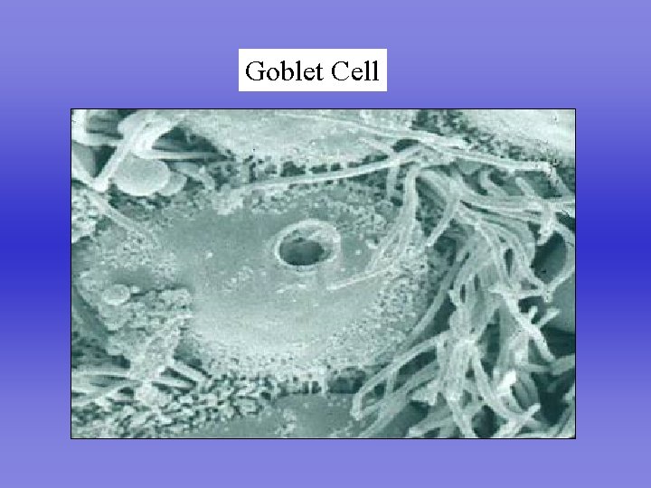 Goblet Cell 