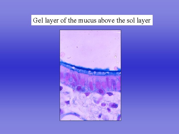 Gel layer of the mucus above the sol layer 