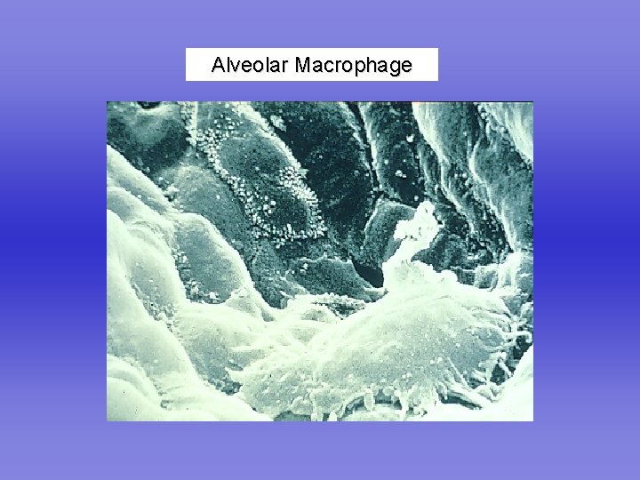 Alveolar Macrophage 