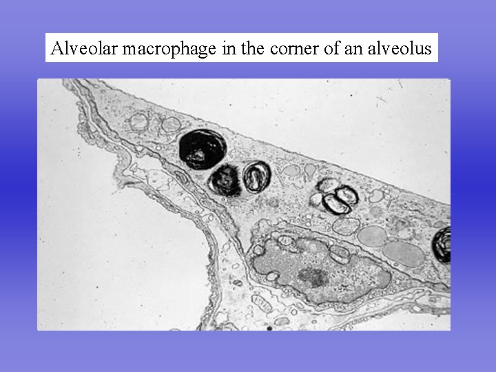 Alveolar macrophage in the corner of an alveolus 