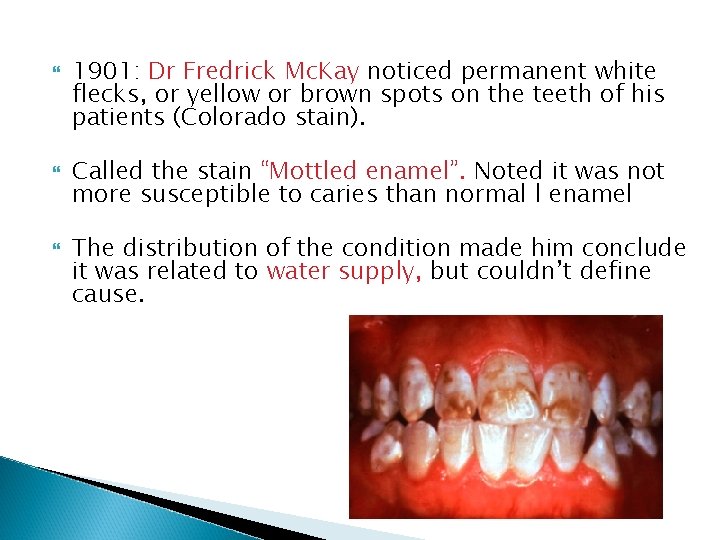  1901: Dr Fredrick Mc. Kay noticed permanent white flecks, or yellow or brown