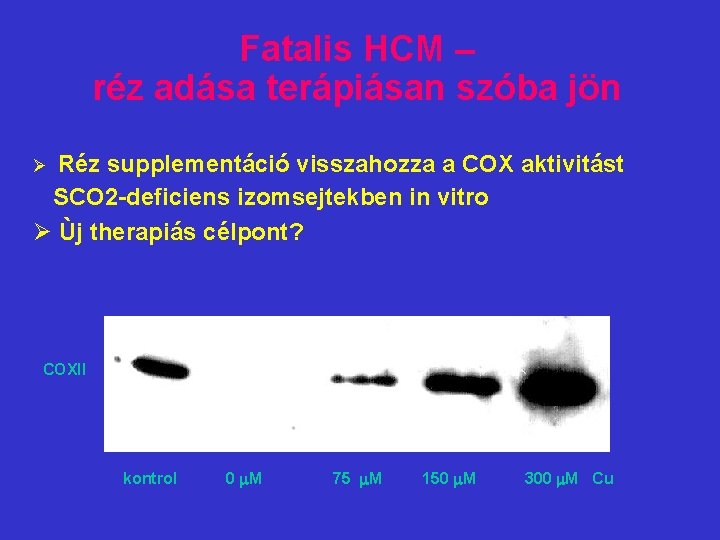 Fatalis HCM – réz adása terápiásan szóba jön Réz supplementáció visszahozza a COX aktivitást