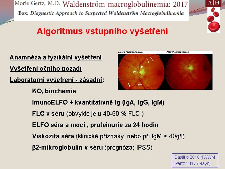 M. WALDENSTRÖM Algoritmus vstupního vyšetření Anamnéza a fyzikální vyšetření Vyšetření očního pozadí Laboratorní vyšetření