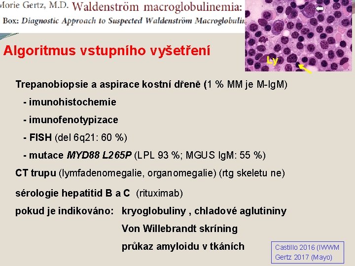 M. WALDENSTRÖM Algoritmus vstupního vyšetření Ly Trepanobiopsie a aspirace kostní dřeně (1 % MM