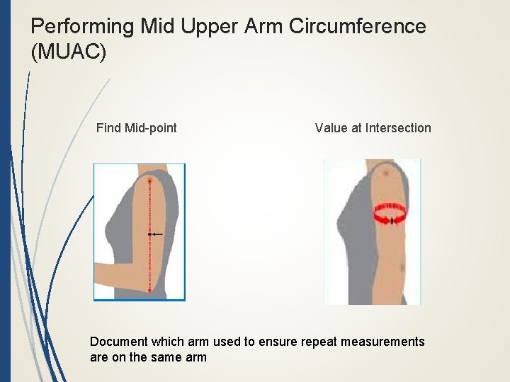 Performing Mid Upper Arm Circumference (MUAC) Find Mid-point Value at Intersection Document which arm