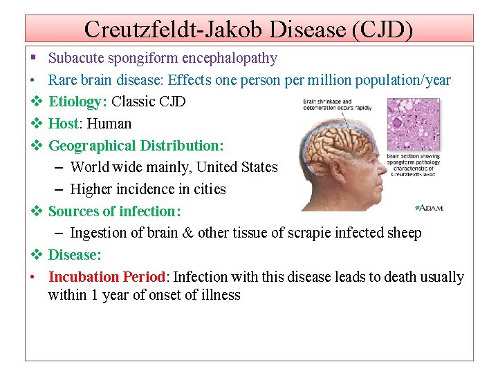 Creutzfeldt-Jakob Disease (CJD) § • v v v Subacute spongiform encephalopathy Rare brain disease: