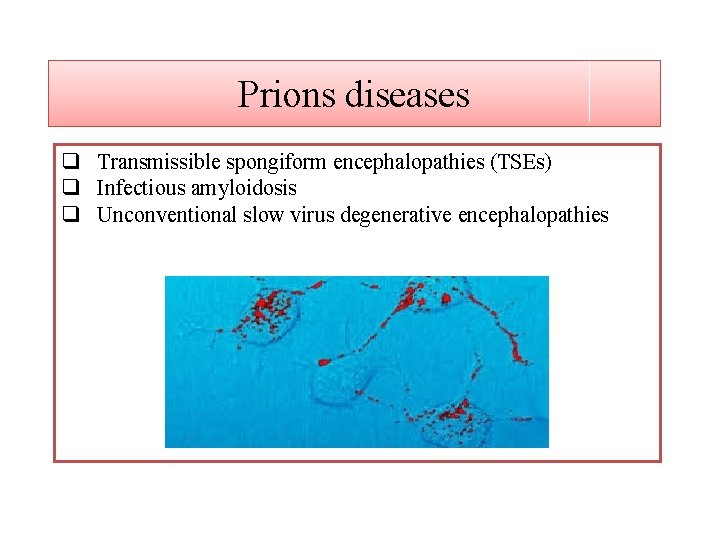 Prions diseases q Transmissible spongiform encephalopathies (TSEs) q Infectious amyloidosis q Unconventional slow virus